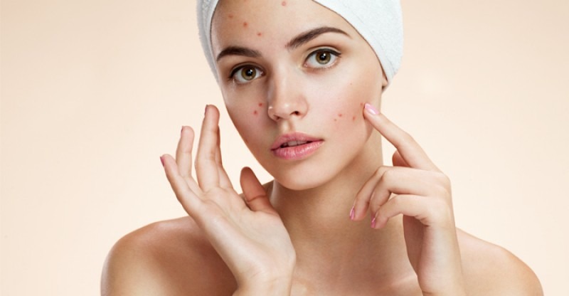 What are the basic types of spots caused by pimples