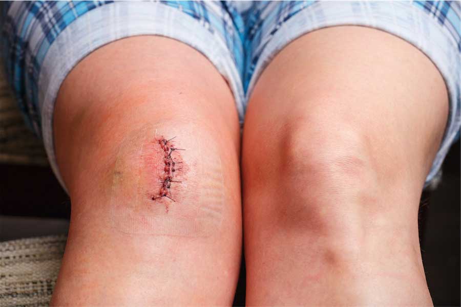 Heals wounds faster