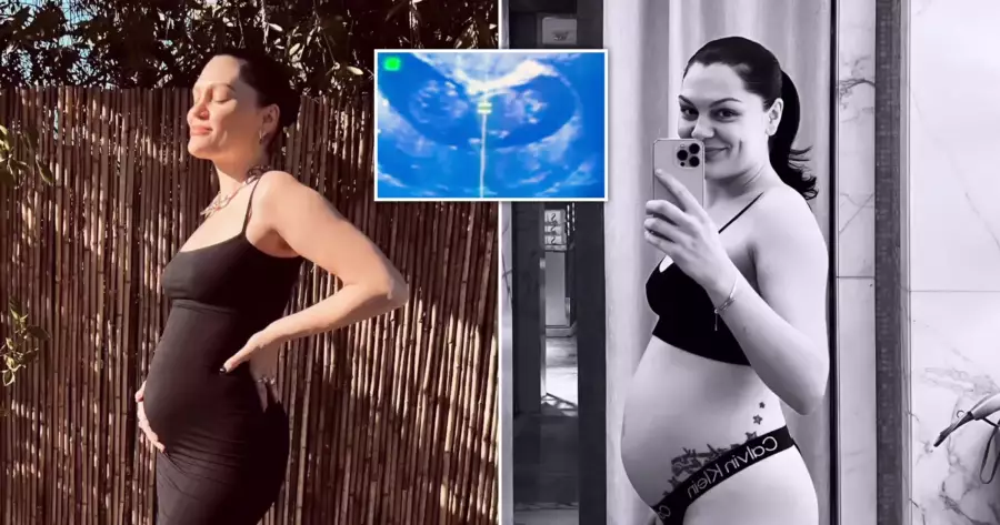 Jessie J Reveals She is Going to Have a Baby Boy