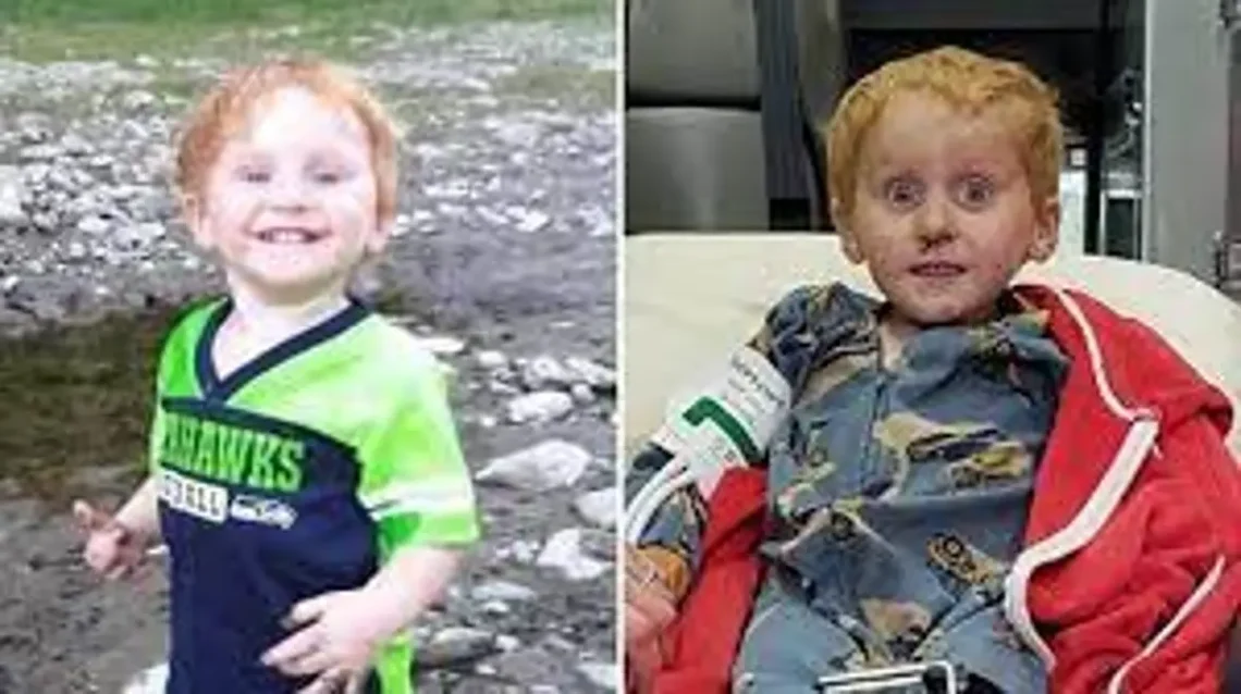 Ryker Webb Before and After